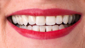 Gerade Zähne - Weiße Zähne - Zahngesundheit - Dr. med. dent. Gabriele Durst - Praxis für innovative und präventive Zahnmedizin