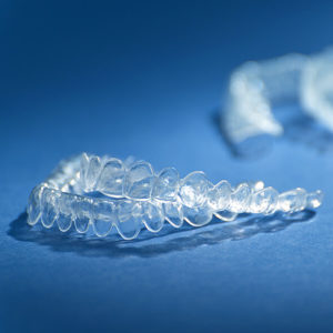 Bleaching - Ästhetische Zahnheilkunde - Dr. med. dent. Gabriele Durst - Praxis für innovative und präventive Zahnmedizin